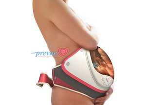 PreVue Fetal Visualization Device Project Melody Shiue