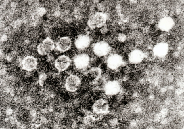 A lepkehimlő kórokozója, a Parvovírus B19