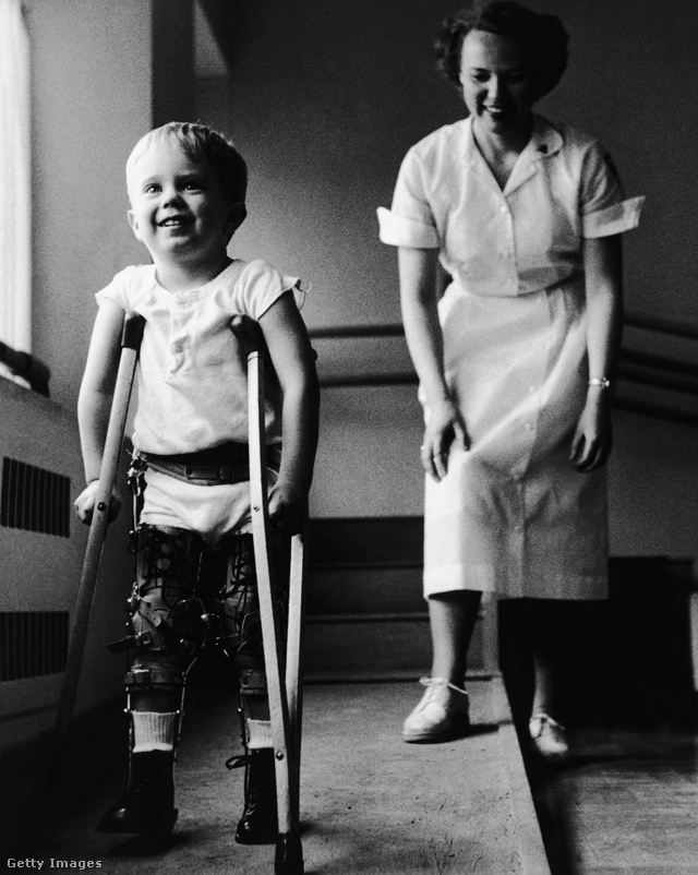Gyermekbénulásból felgyógyult kisfiú járni tanul (1950-es évek).