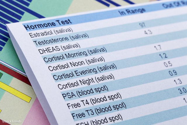 stockfresh 1317037 hormone-test sizeM