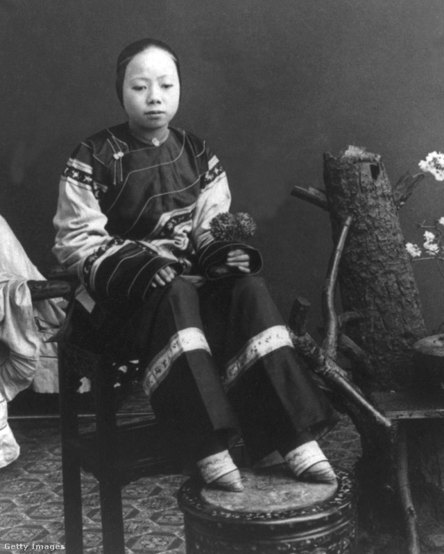 Hátrakötött lábú kínai lány 1912-ben