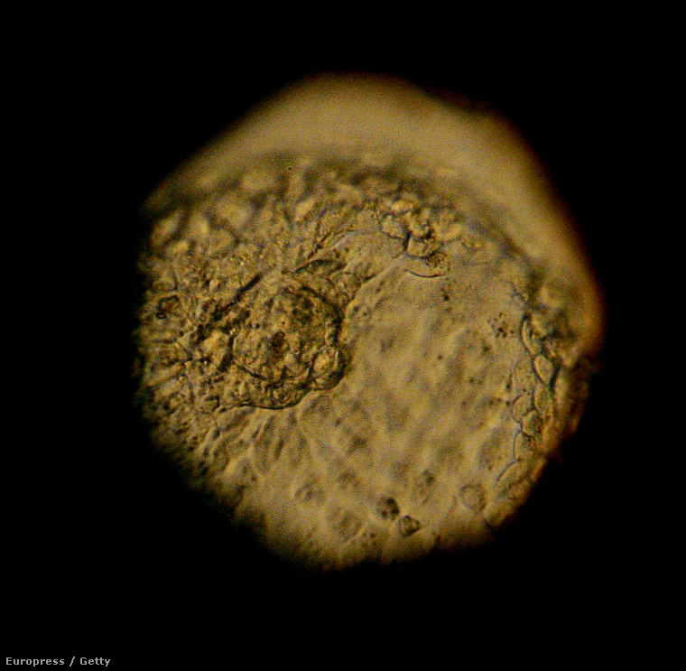 Embrió mikroszkóp alatt egy kaliforniai embrió bankban