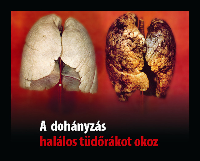 A passzív dohányzás hatásai | fikszpontegyesulet.hu