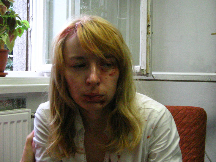 A pozsonyi Új Szó című lap felvételén MALINA Hedvig nyitrai magyar diáklány látható 2006. augusztus 25-én, közvetlenül az incidens után a nyitrai egyetemen.