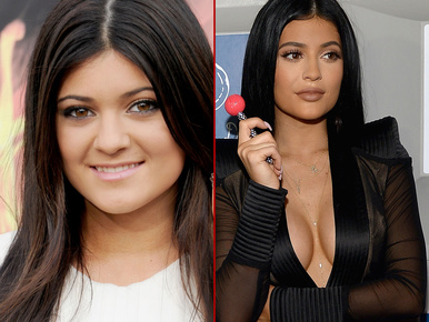 Képzelje, Kylie Jenner irtó bölcs döntéseket hoz a külsejét illetően