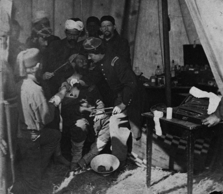 Sérült katonát látnak el és készítenek elő amputációra egy egy tábori kórházban, 1863-ban, az amerikai polgárháborúban.