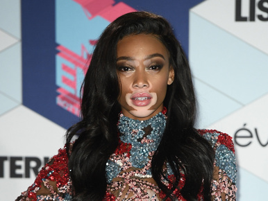 A gyönyörű Winnie Harlow bemutatja: az MTV EMA győztesei