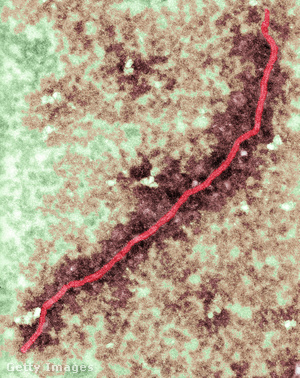 Nipah vírus mikroszkópos képe