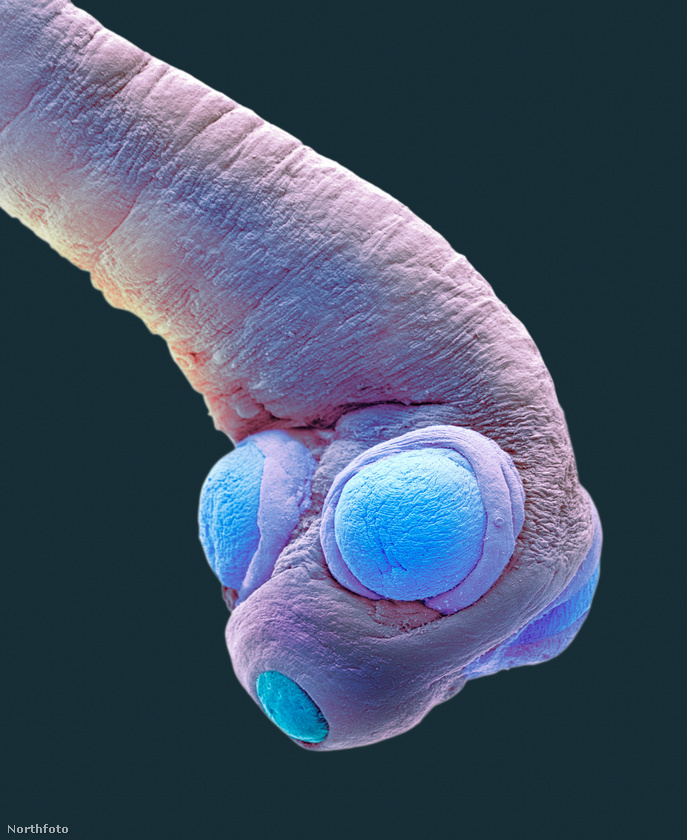 Nem mondunk újdonságot azzal, hogy az emberi test mikrobák milliárdjainak ad otthont
