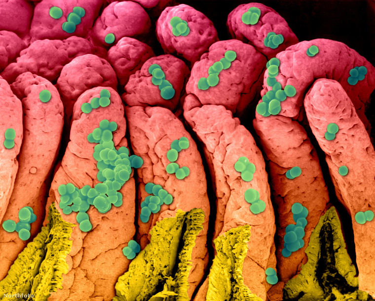 Ez pedig itt a gyomor-bélhurut fő okozója, a Staphylococcus nevű baktérium