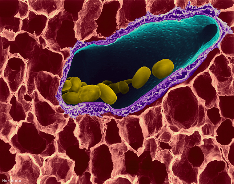 Ezek a kis füldugó kinézetű baktériumok a Bacillus anthracis névre hallgatnak