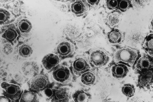 Herpes simplex virus TEM B82-0474 lores