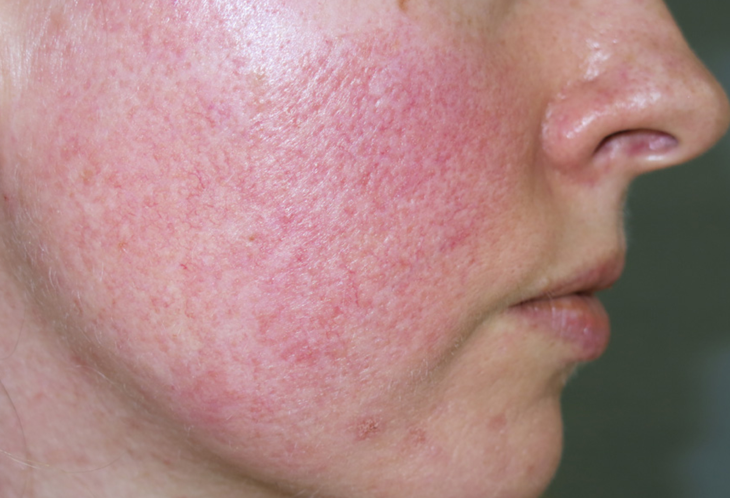 arcbőr problémák lelki okai papilloma vírus és hányinger