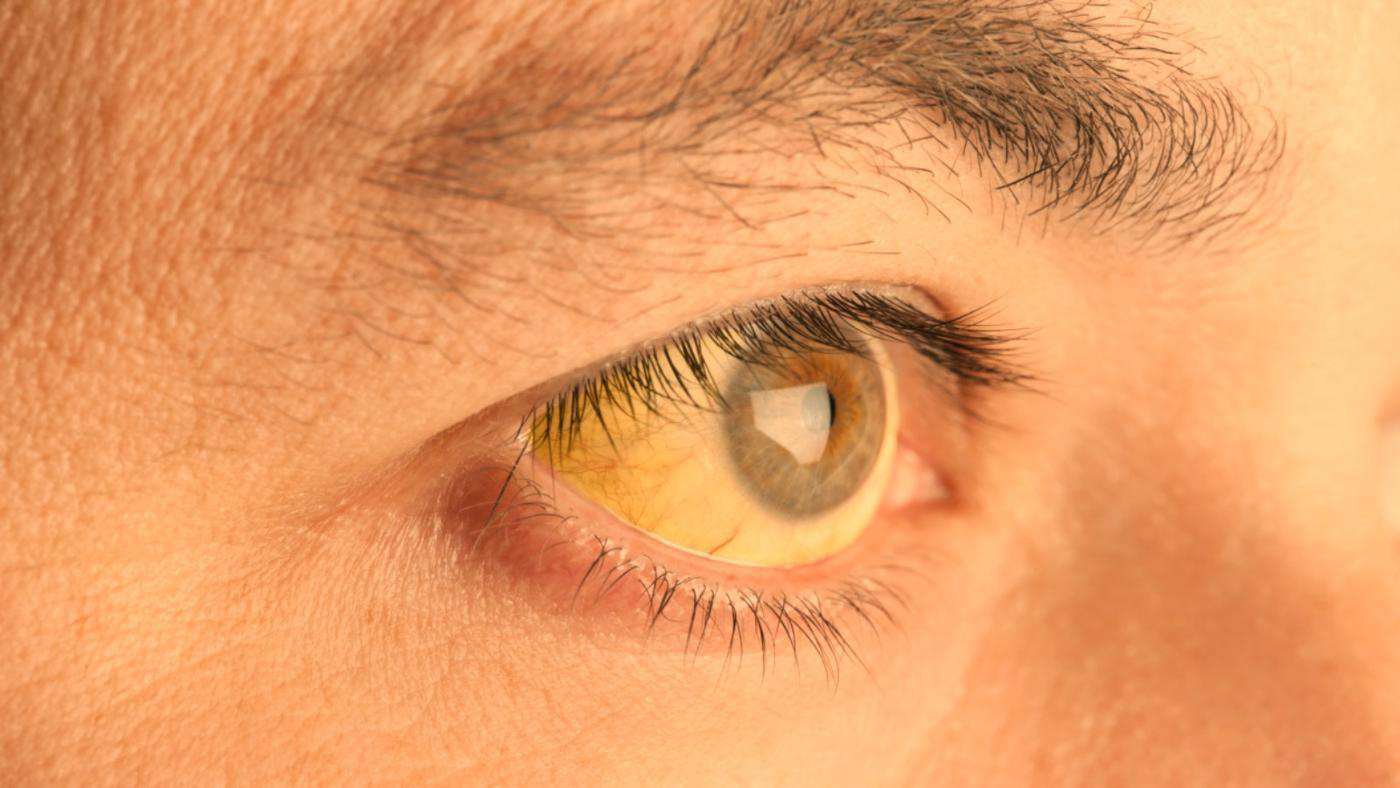 milyen szembetegségek vannak látás és chondrosis