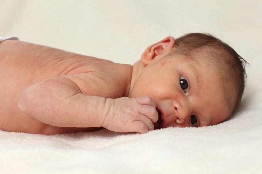 
                        	Az ekcéma a babák 8-15%-ánál jelenik meg. A viszketés számukra még nehezebben elviselhető. Az ilyen korai ekcéma jelezheti a betegség későbbi megjelenését is, de sok kicsi kinövi a betegséget.