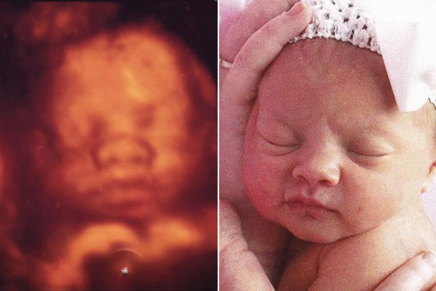 	Pisze orr és csajos arcvonások: a kicsiről a pocakban készült felvétel és a születése utáni fotó szinte csak színeiben különbözik egymástól.