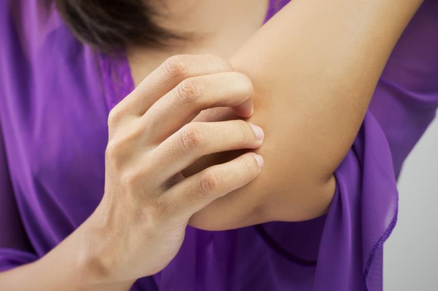	A cukorbetegségnek bőrtünete is lehet, gyakoribbá válhatnak a gombás és bakteriális fertőzések, emellett jellemző a viszketés is.