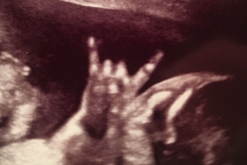 Ez a baba született rocker lesz, már az ultrahangon sejthették.
