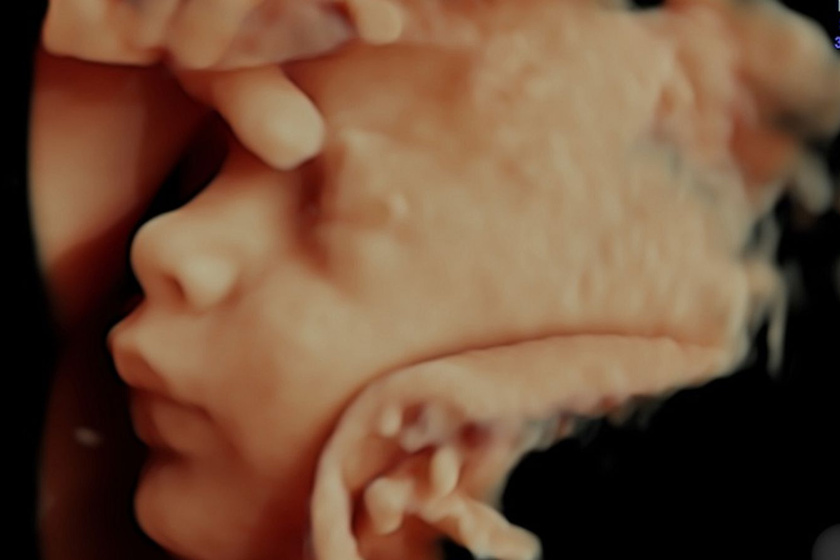 Ennek a kisbabának már tele van a hócipője a folytonos ultrahangos fotózással, és ezt arisztokratikus kéztartással juttatja tudomásunkra.
