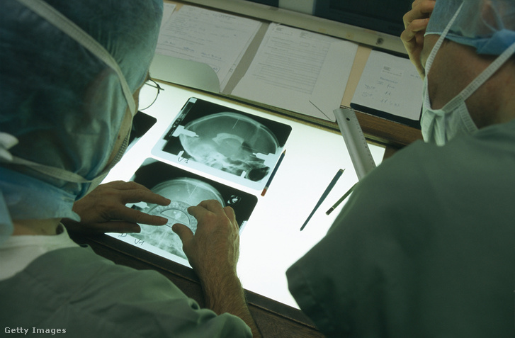Parkinson-kórban szenvedő beteg röntgenképeit vizsgálják egy francia klinikán.