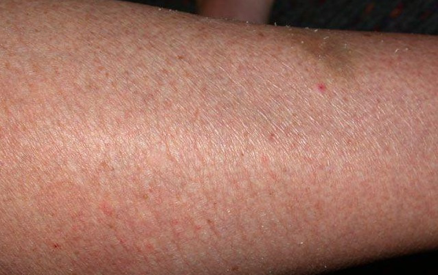 A száraz bőr okai és kezelése