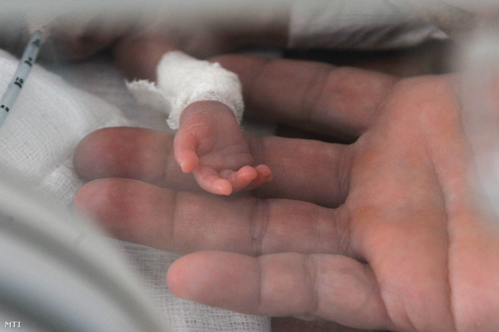 Koraszülött csecsemő kezét tartja egy asszisztens