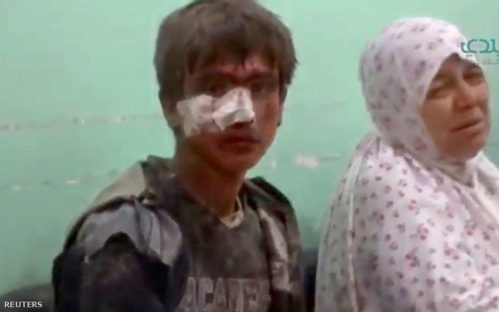 Sebesült fiú az idlibi kórházban, szeptember 29-én