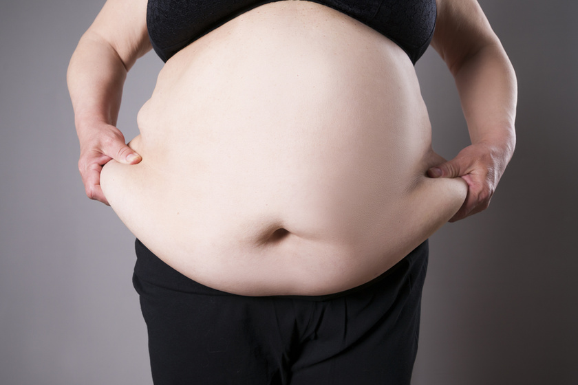 a túlsúlyos fogyás meghatározása de sovány fogyás