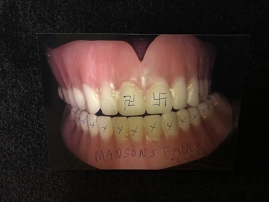 Múzeumba viszik Charles Manson műfogsorát