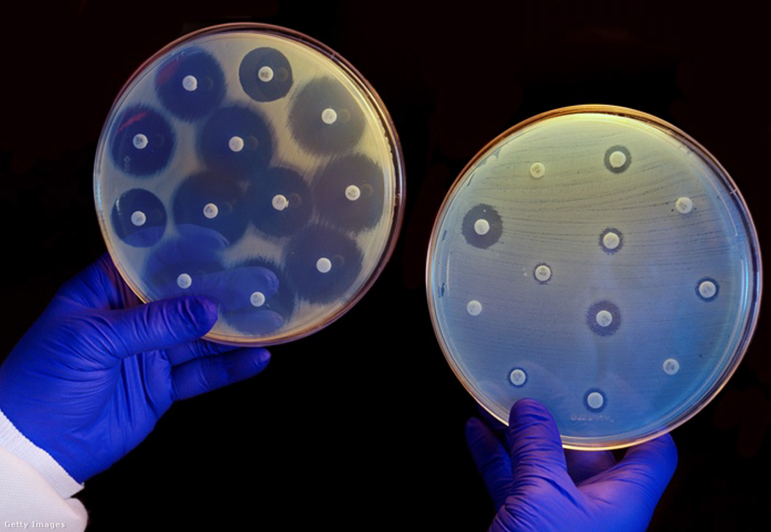 Balra: antibiotikumra érzékeny baktériumok tenyészete, jobbra antibiotikum-rezisztens baktériumok tenyészete – jól látható, hogy az utóbbiak szinte teljesen körbevették az antibiotikummal átitatott vattadarabokat