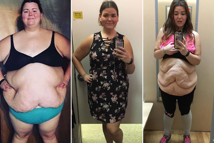 Egy fogyás története: 35 kilót adott le önsanyargatás nélkül Fogyás otthon sikertörténetek