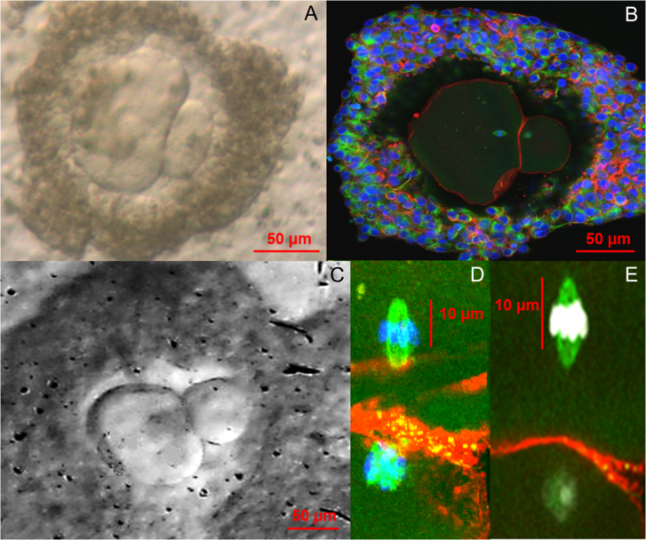 Laborban növesztett emberi petesejtek mikroszkópos képei