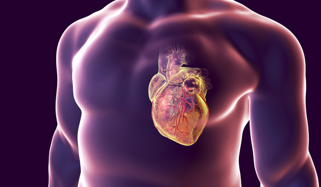 szív egészségügyi hulladék mérete miért fordul elő ödéma magas vérnyomás esetén