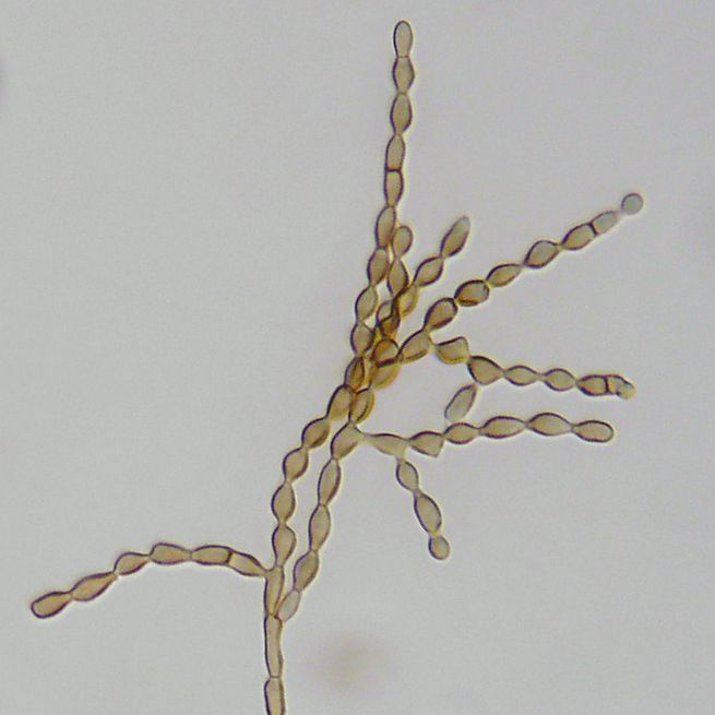 Cladosporium cladosporioides