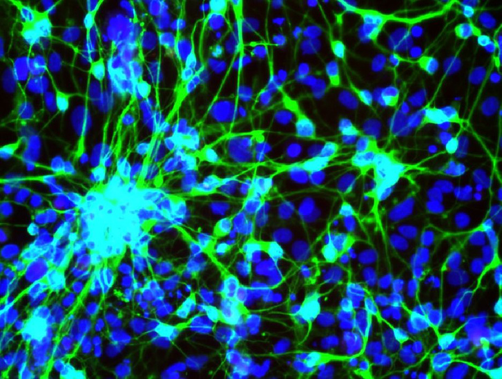 Immunfluoerszcens jelöléssel láthatóvá tett humán indukált neuronok
