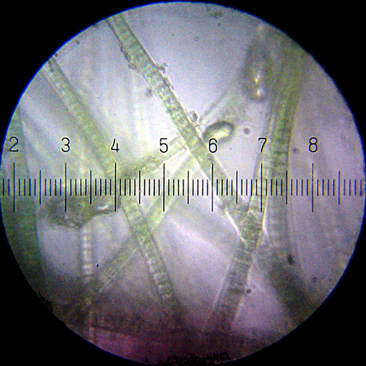Cianobaktériumok mikroszkóp alatt