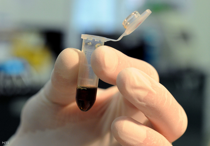DNS vizsgálatra előkészített vérminta látható Bűnügyi Szakértői Kutatóintézet (az NSZKK elődje) laboratóriumában 2011 szeptemberében.
