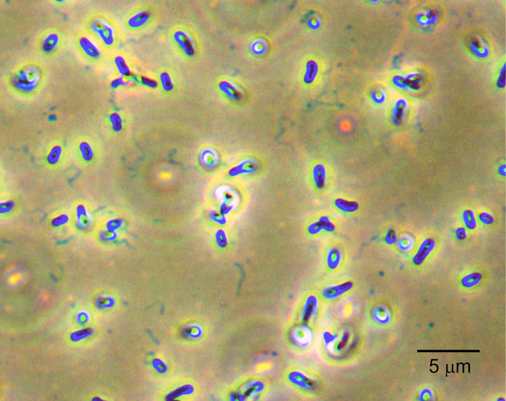 A Rhizobium aquaticum baktérium fénymikroszkópos képe kristályibolyát tartalmazó csillófestékkel történő festés után