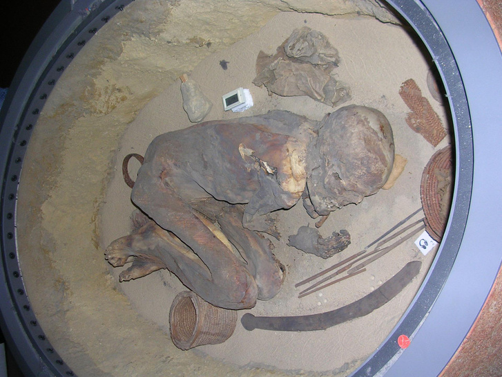 A vizsgált kb. 5600 éves múmia
