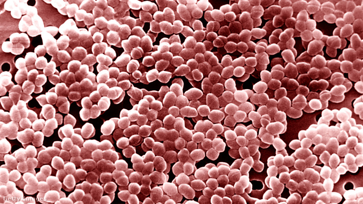 Enterococci Genus Enterococcus Gram hasznos baktériumok. Az enterococci baktériumok jelen vannak az ember és az állatok bélrendszerében, de a talajban és a vízben is.