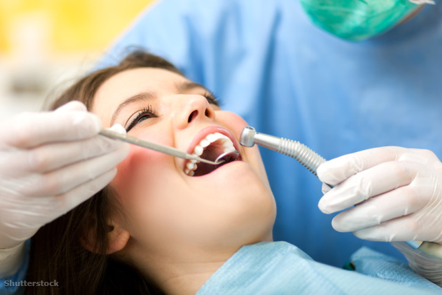 Tévhitek a fogápolásról és a szájhigiéniáról