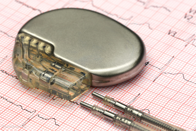 A pacemaker a szívelégtelenséggel küzdő betegeken is segíteni tud.