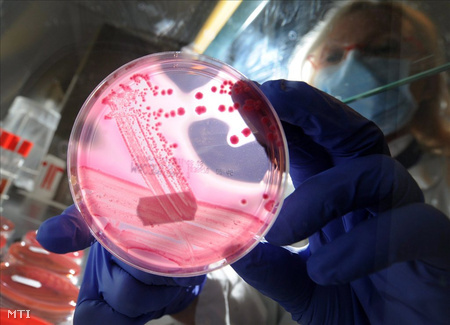 A hamburgi Higiéniai és Környezeti Intézet dolgozója az Escherichia coli, azaz a kólibaktérium egyik válfaját képviselő EHEC bélbacilusokat tartalmazó Petri-csészével