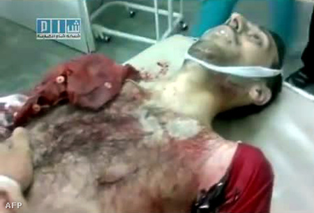 A tegnapi homszi tüntetés egyik áldozata