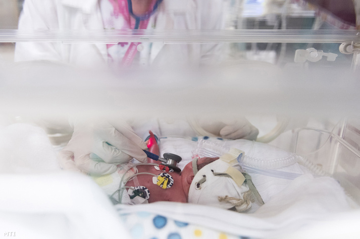 Koraszülött gyermeket vizsgál egy orvos a nyíregyházi Jósa András Oktató Kórház Gyermekosztályának Perinatális Intenzív Centrumában 2018. november 15-én.