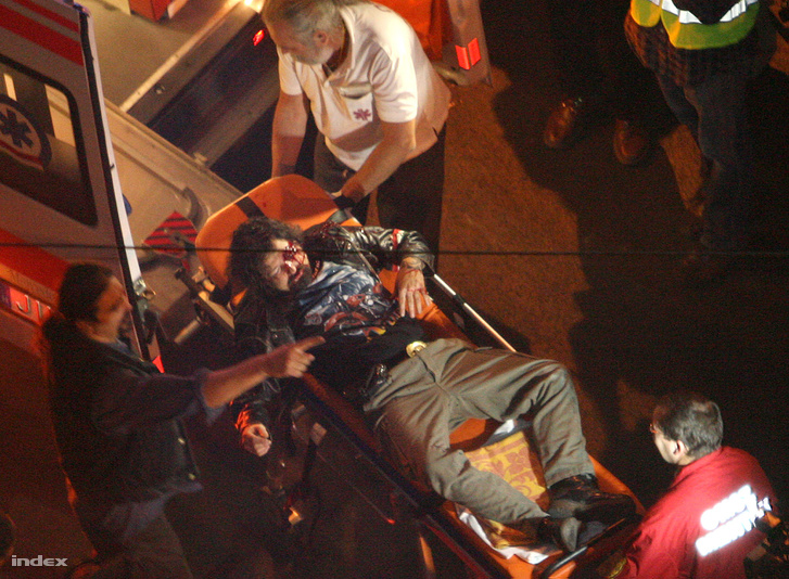 Gumilövedékkel kilőtt szemű férfi 2006 őszén