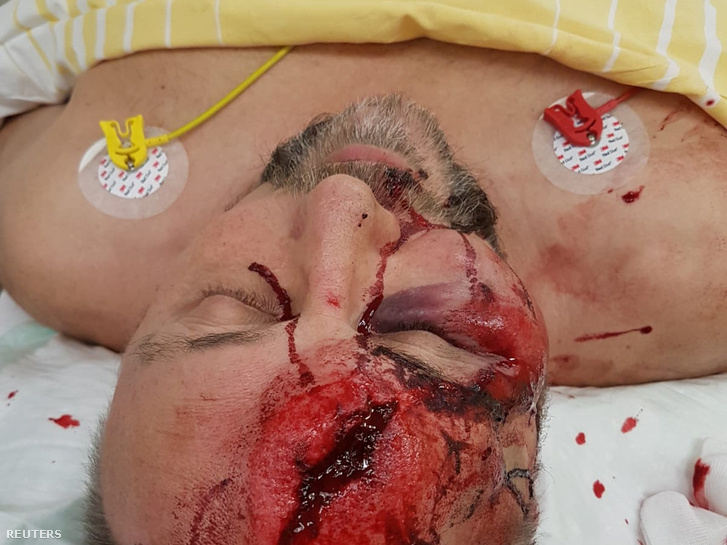 Frank Magnitz sérülése a támadás után, Bremenben 2019. január 7-én