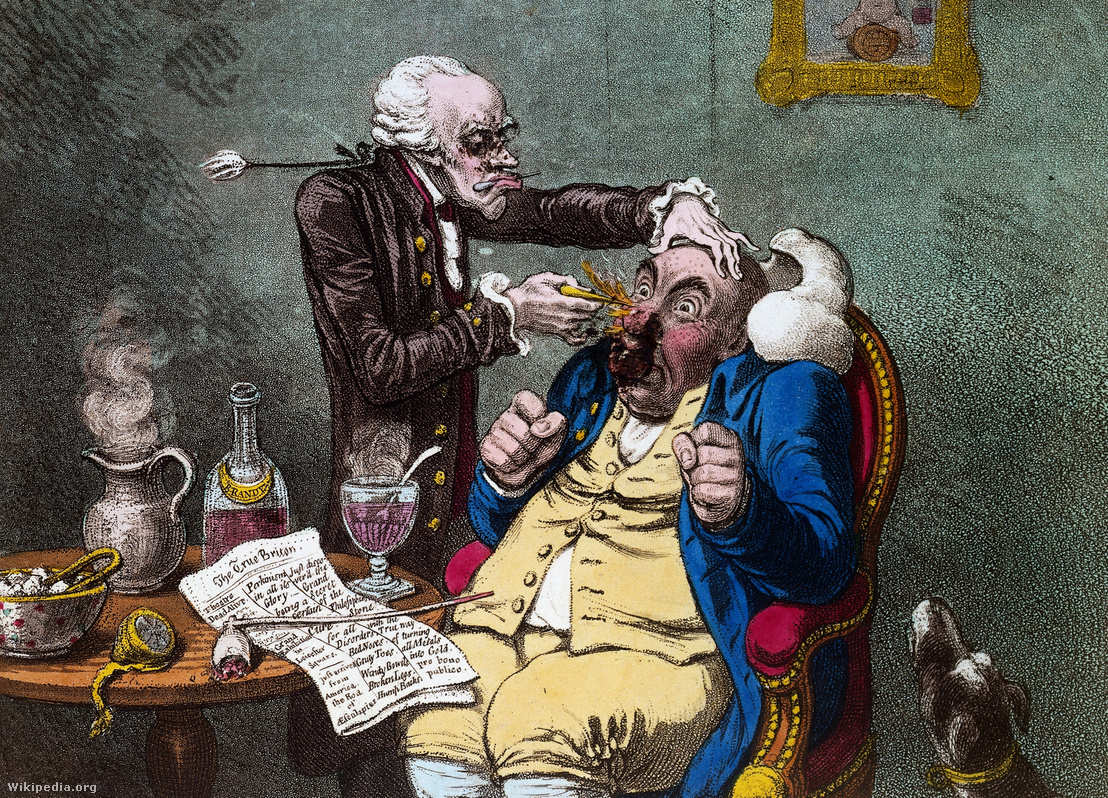 James Gillray 1801-es karikatúrája, amin egy gyógyító kezeli a pácienst Elisha Perkins által készített Perkins Patent Tractors eszközzel, ami később az első placebo-kutatás alapját képezte