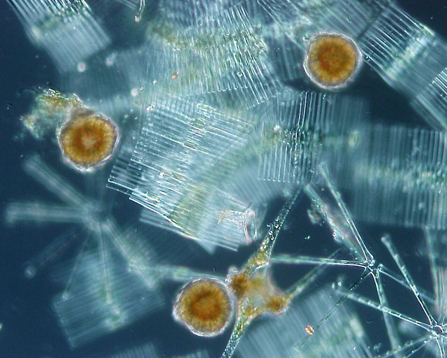Fitoplankton-szervezetek: a kovamoszatok világos színűek, a nem kovamoszat-szervezetek barnásak