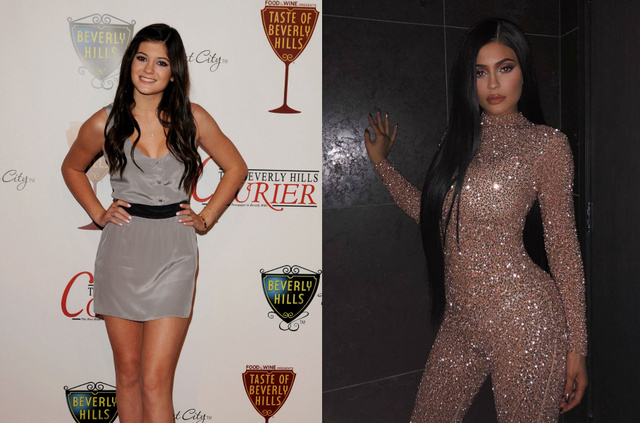 Egy látványos majdnem #10yearschallenge: Kylie Jenner 2010-ben és 2018 decemberében.